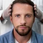 Causes et solutions perte de cheveux, Perte de cheveux