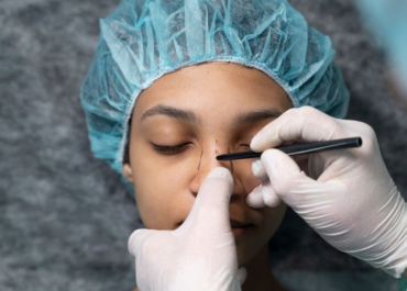 Tout savoir sur la rhinoplastie