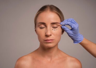 Blépharoplastie : Qu’est-ce que c’est ? Tout ce que vous devez savoir