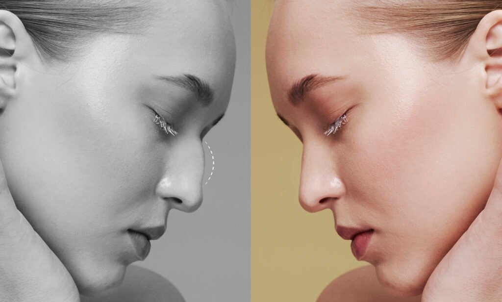 Beauté Naturelle vs. Transformation Artificielle